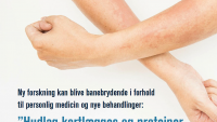 Skærmbillede af artiklens titel fra Hud & Helse magasinet