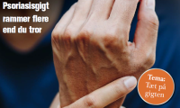 Billede til udgivelsesnyhed hud og helse, nr. 2, 2026,