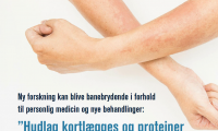 Skærmbillede af artiklens titel fra Hud & Helse magasinet