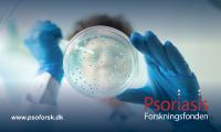 Forsker står med en petriskål, i hjørnet af billedet er logo for Psoriasis Forskningsfonden.