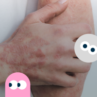 Nærbillede af en hånd og arm med psoriasis på - strøet med små grafiske, farvede figurer med runde øjne, der stirrer. 